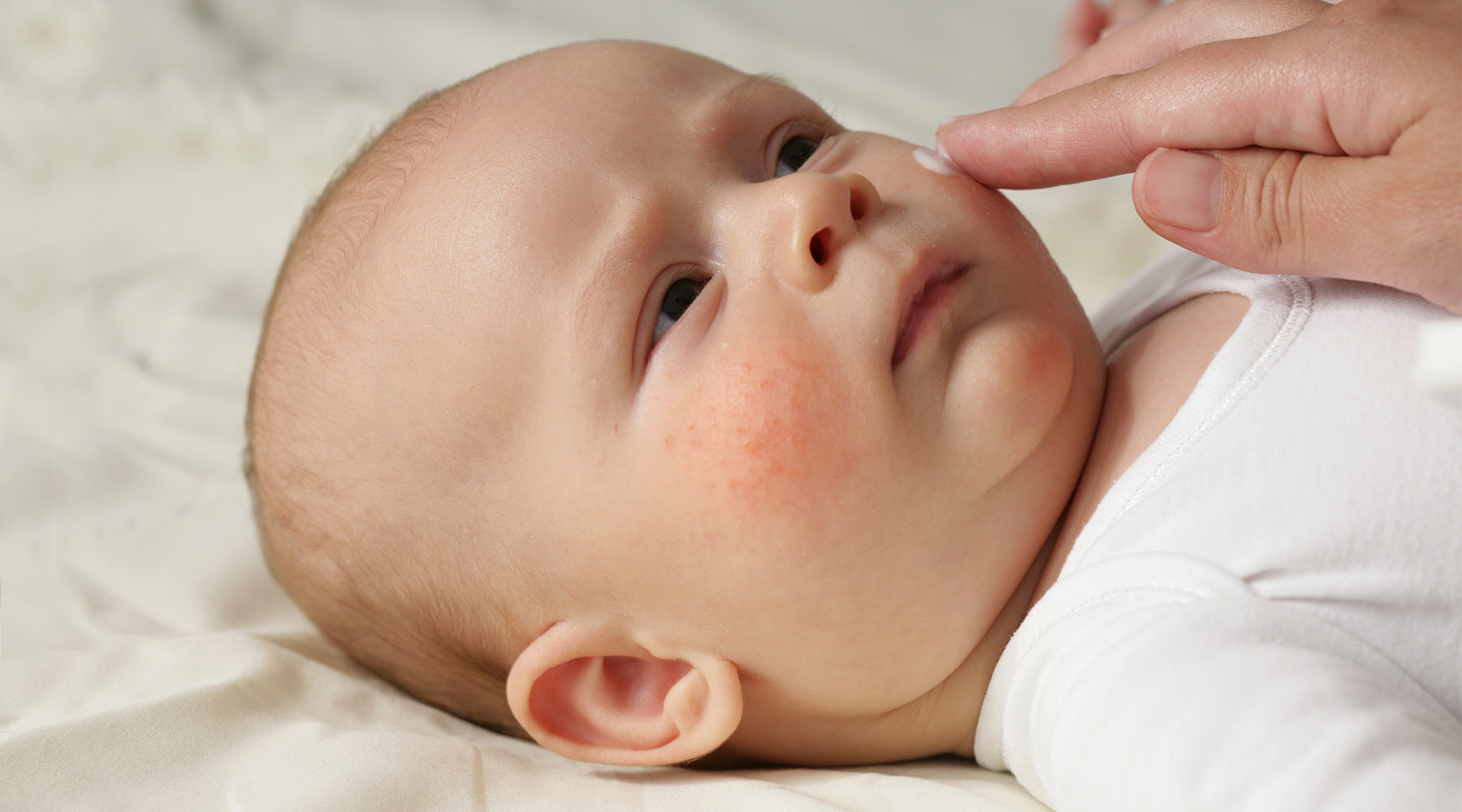 Rubbing cream on baby with eczema